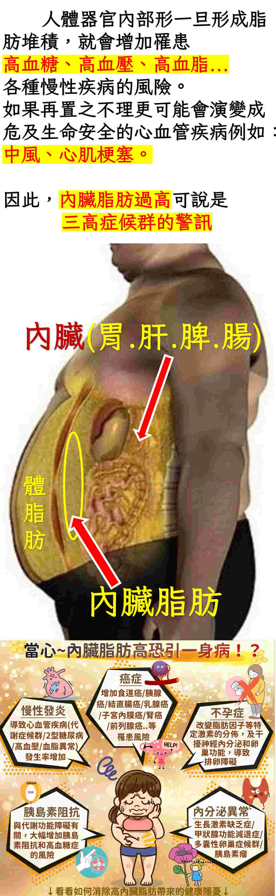 內臟脂肪說明圖